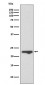 Anti-MUC1 Rabbit Monoclonal Antibody